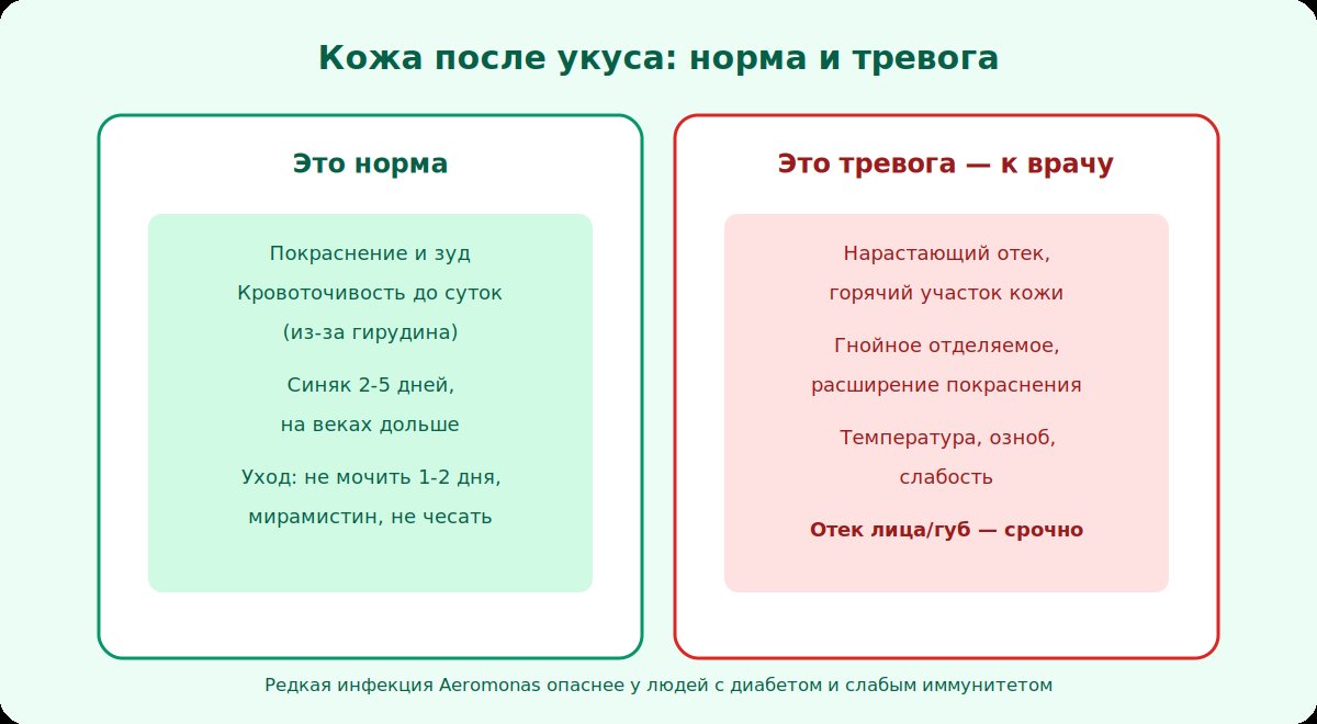Кожа после укуса пиявки: норма и тревожные признаки, требующие врача