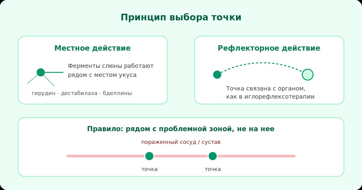 Принцип постановки пиявки: точка рядом с проблемной зоной, местное и рефлекторное действие