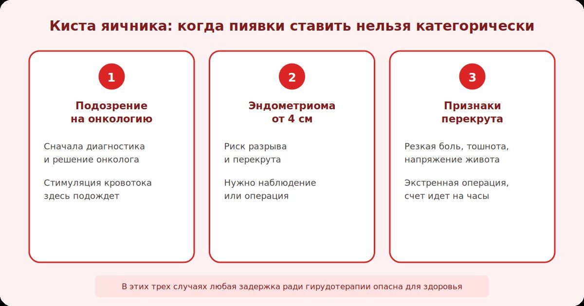 Три жестких противопоказания при кисте яичника: подозрение на онкологию, крупная эндометриома, признаки перекрута